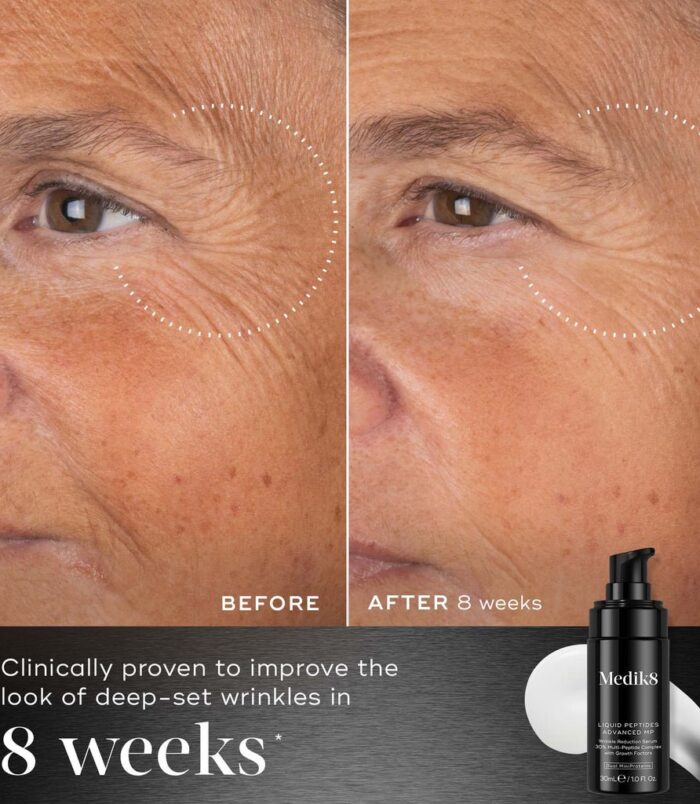 2026/02/72838.jpg 2026/02/72838.jpg